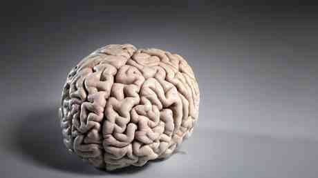 Covid kann Gehirnschrumpfung verursachen Studienergebnisse — World
