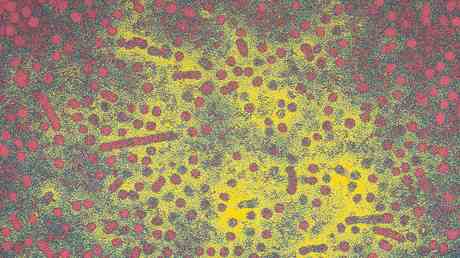 CDC untersucht Welle von Hepatitis Faellen bei Kindern — World