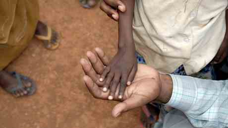 Rekordwerte des Kinderhungers am Horn von Afrika — World