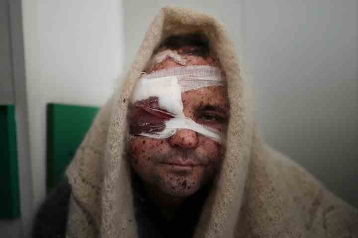 Serhiy Kralya, 41 ans, regarde la caméra après une opération dans un hôpital de Marioupol, dans l'est de l'Ukraine, le vendredi 11 mars 2022.  Kralya a été blessé sous le feu des forces russes.  (AP Photo/Evgueni Maloletka)