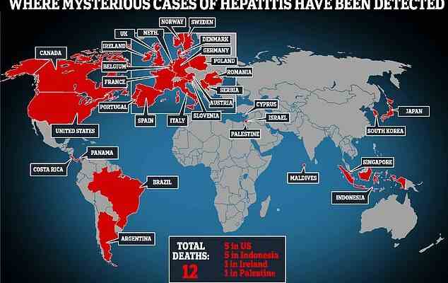 20 autres enfants britanniques contractent une mysterieuse hepatite