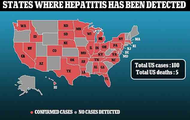 CDC 71 nouveaux cas dhepatite pediatrique mysterieuse