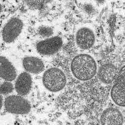 141 habitants dAmsterdam infectes par le virus de la variole
