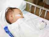 Veelbelovend middel tegen RS-virus: baby's gaan hiervan profiteren