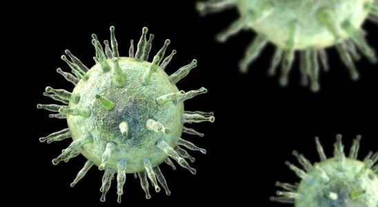 A very common virus appears to cause multiple sclerosis