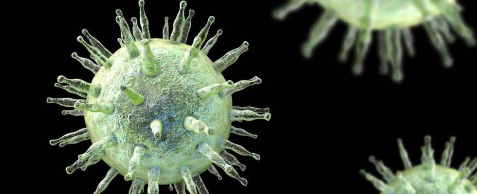 A very common virus appears to cause multiple sclerosis