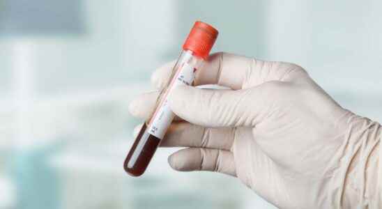 Blood test why should you be fasting before a blood