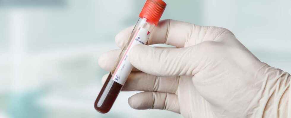 Blood test why should you be fasting before a blood