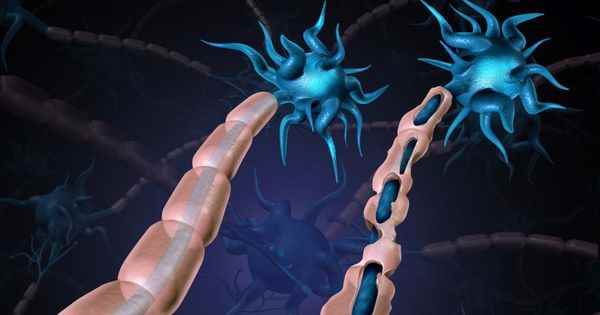 Multiple sclerosis the Epstein Barr virus is one of the main