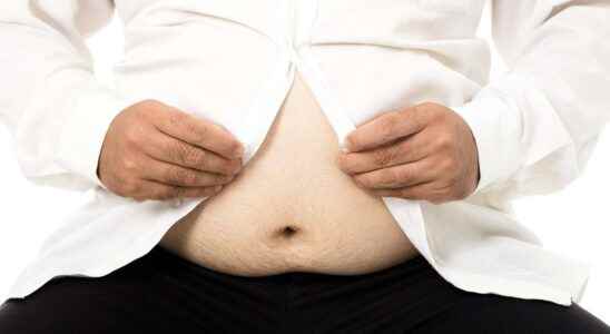 Thanks to their genes some obese people are relatively healthy