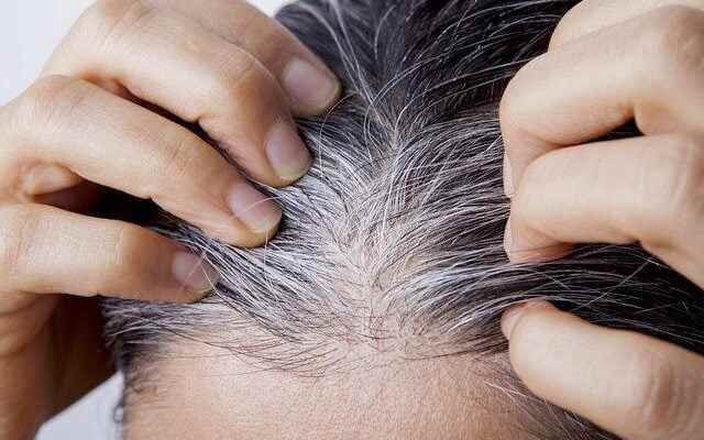 The most natural way to remove white hair Here is
