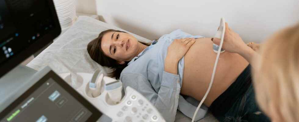 4 tips before going to your pregnancy ultrasound