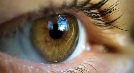 An eye scan can predict your risk of heart attack