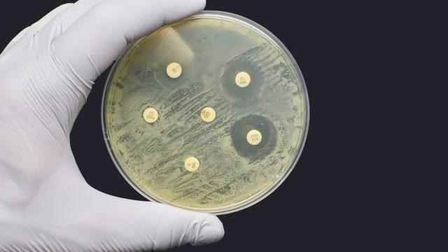 Antibiotic resistant bacteria killed more than 1 million people in 2019