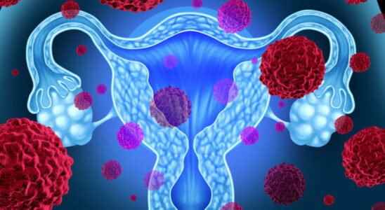 Cervical cancer symptoms vaccine what treatments