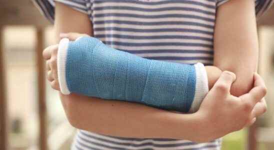 Fractures better identify them thanks to artificial intelligence