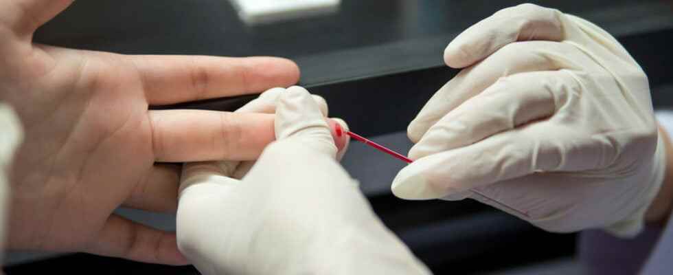 HIV screening test free and without a prescription in the
