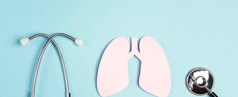 Lung cancer screening in France soon to be generalized