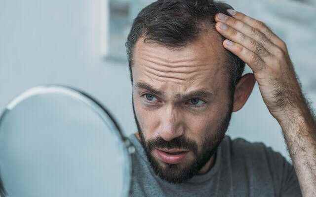 Miraculous methods for hair loss You can prevent spillage