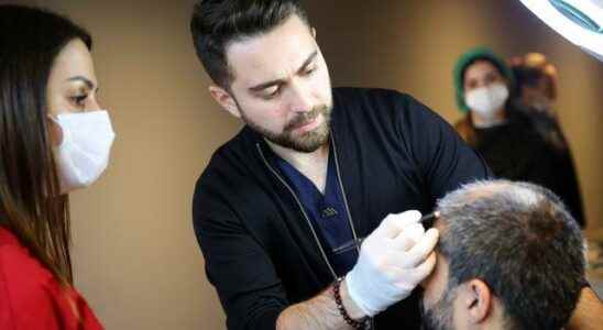 Say goodbye to baldness with stem cell hair transplantation