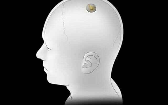 What was said about Elon Musks Neuralink brain chip project