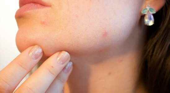 Your skin problems may be caused by this reason