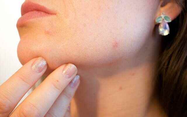 Your skin problems may be caused by this reason