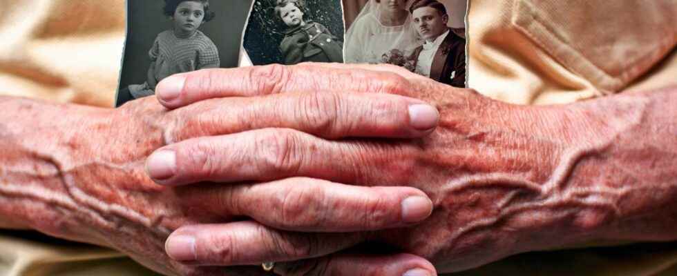 Alzheimers disease what factors influence life expectancy
