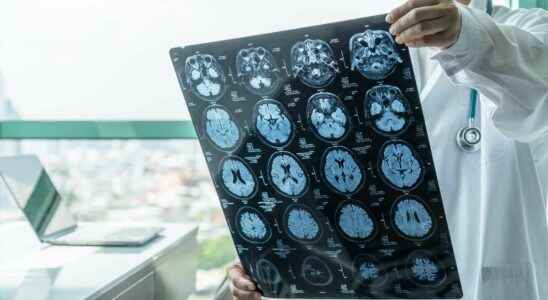 Brain week towards faster diagnosis of psychiatric diseases thanks to