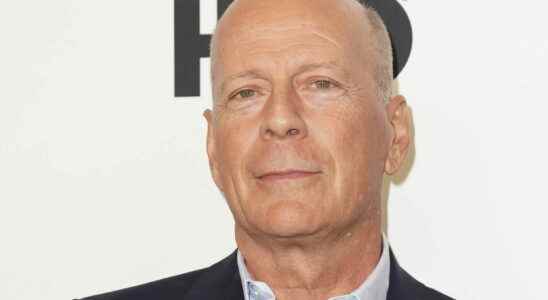 Bruce Willis what is aphasia a disease that led him