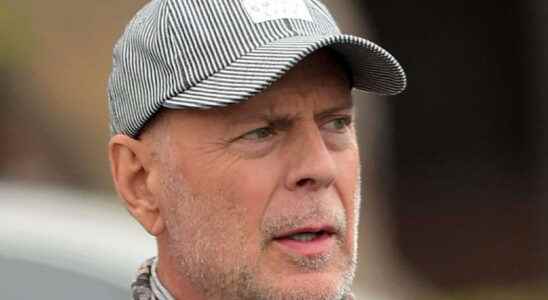 Bruce Willis what is aphasia the disease from which the