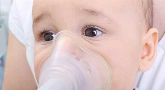 Croup warning symptoms a complication of Covid