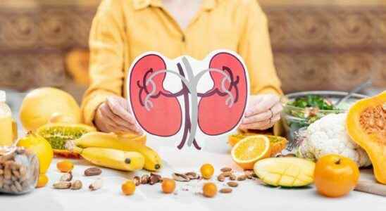 Does eating meat cause kidney stones Can kidney stones be