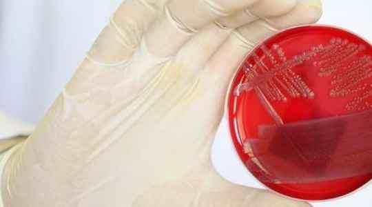 Ecoli bacteria what are the health hazards in the event