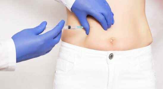 How to lose weight with stomach botox What is stomach