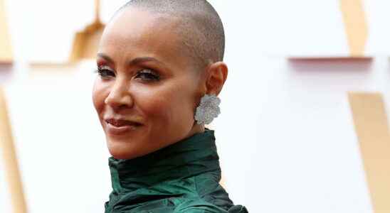 Jada Pinkett Smith what is alopecia the disease from which
