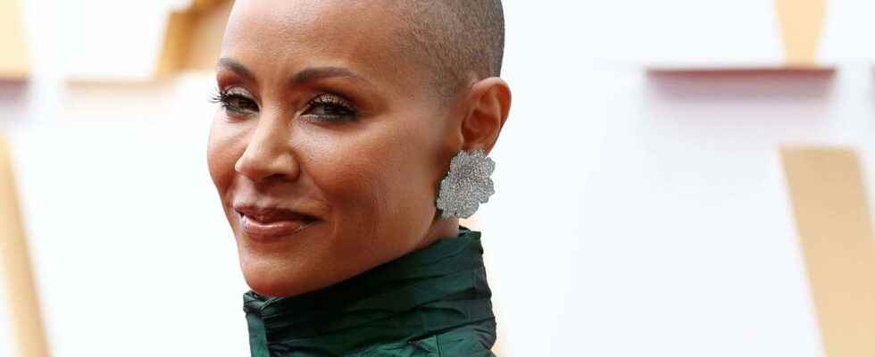 Jada Pinkett Smith what is alopecia the disease from which