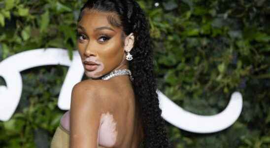 Model Winnie Harlow launches her brand of sun care products