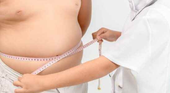 Overweight and obesity in children towards better care