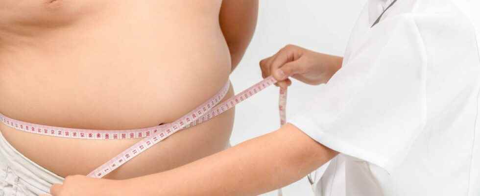 Overweight and obesity in children towards better care