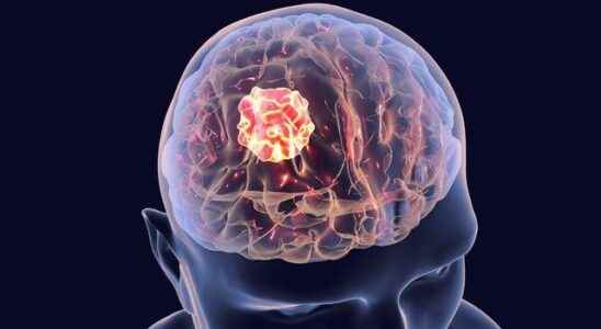 Pandemic threatens brain health These signals cannot be ignored