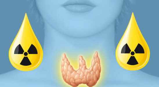 Radioactive iodine risks what danger for the thyroid