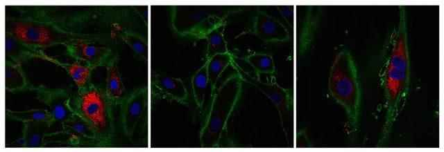 scientists-skin-cells-regenerated-53-year-old-woman-by-30-years_2255_dhaphoto1