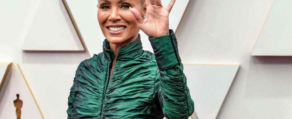 Alopecia what is this disease suffered by Jada Pinkett Smith
