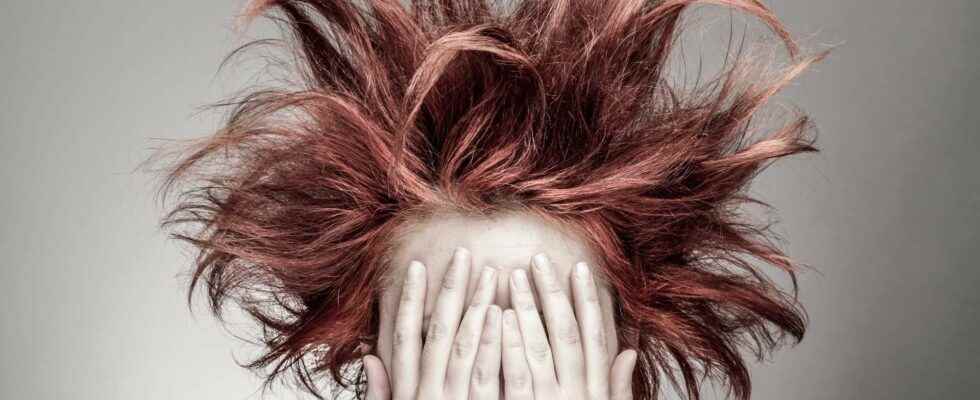 Bizarre patient this strange disease that makes hair indomitable