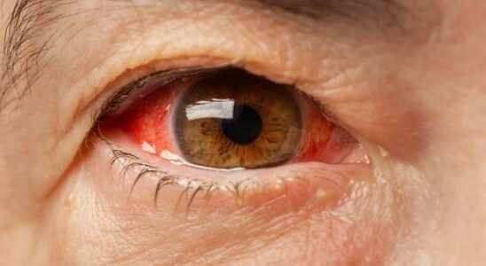 Causes serious damage May cause blindness