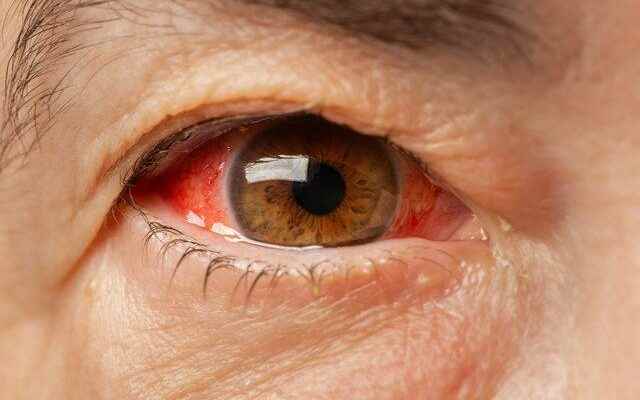 Causes serious damage May cause blindness