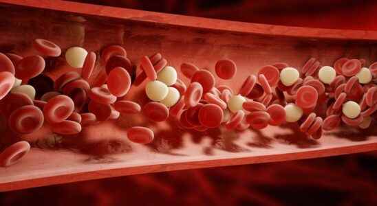 Covid 19 increases the risk of blood clots up to 6
