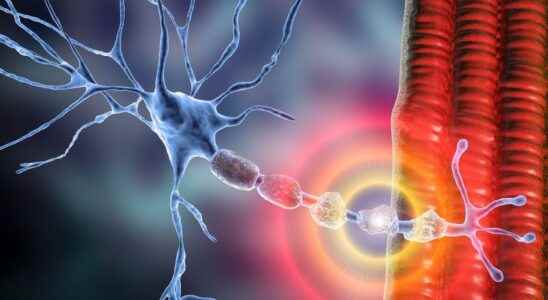 Multiple sclerosis stopped thanks to immune cells directed against the