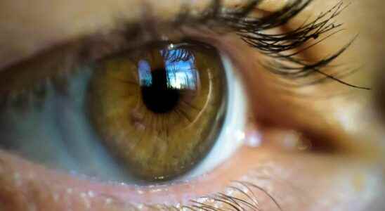 Retinal occlusion a new symptom of Covid 19